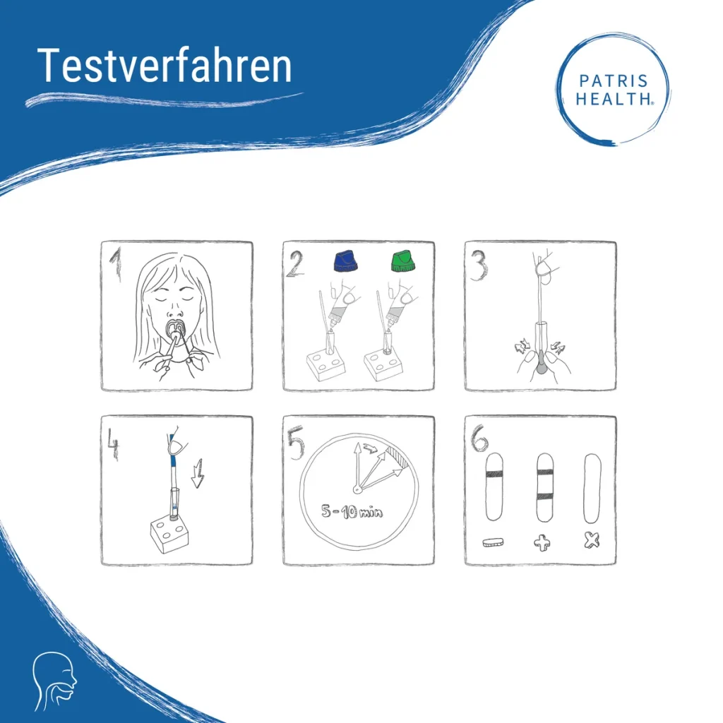 Testverfahren Strep A Selbsttest – Rachenabstrich, Extraktion, Ergebnis nach 5–10 Minuten