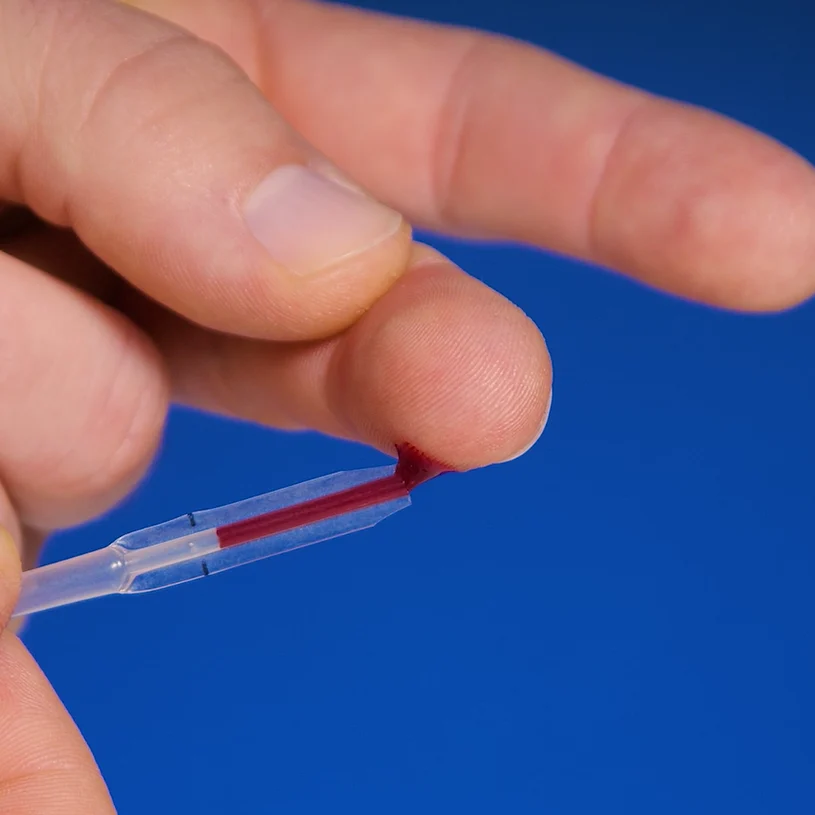 Probe nehmen: ein Tropfen Blut aus der Fingerkuppe
