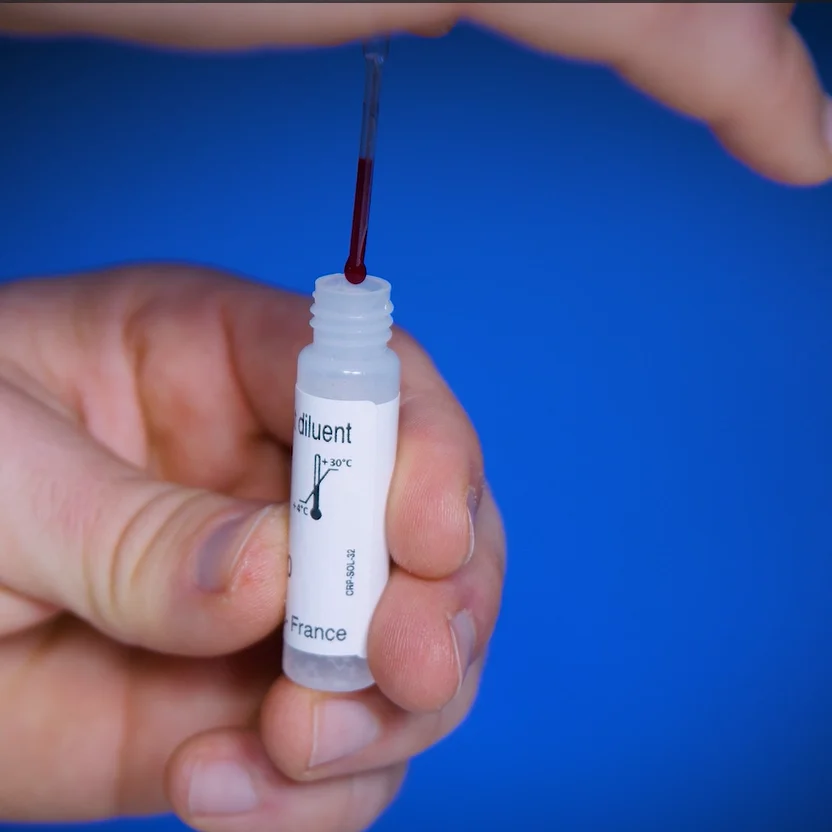 Patris Health CRP-Selbsttest – Schritt 3, das Blut wird in die Tropfflasche mit Verdünnungsmittel gegeben