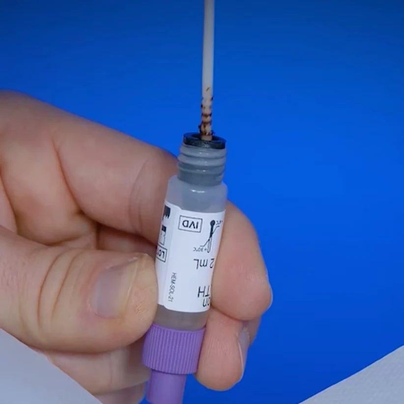 Patris Health Calprotectin-Selbsttest – Schritt 2, der Probenentnahmestab wird zurück in das Fläschchen mit der Extraktionslösung gesteckt