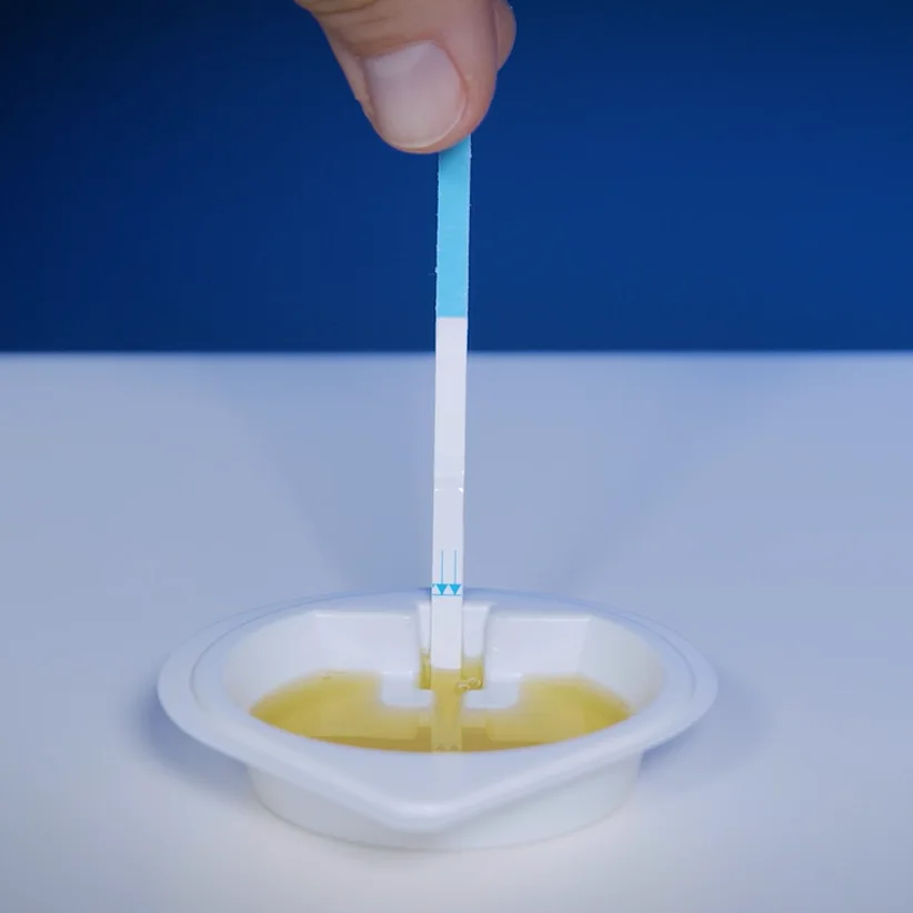 Urinprobe: der Teststreifen steht im Becher